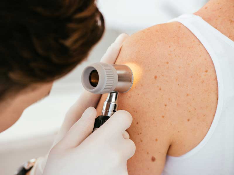 Dermatologist is Checking Patient's Skin